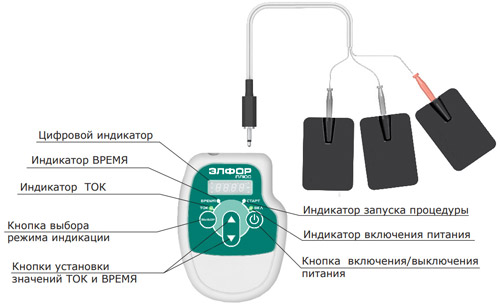 Элфор-Плюс схема подключения электродов